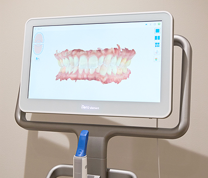 3Dシミュレーション(iTero)を標準搭載