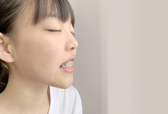 小児矯正とは？早期治療の重要性