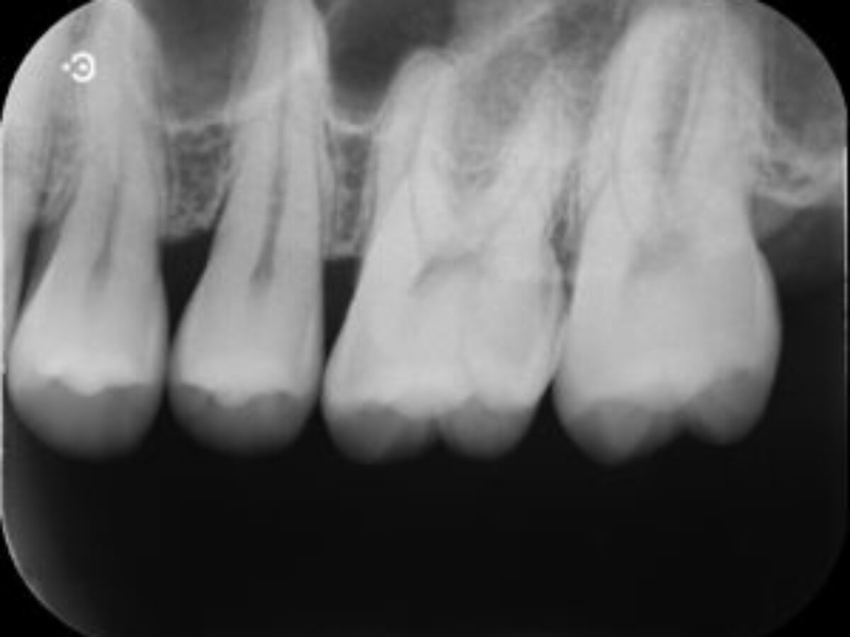 東京歯材社 投影ライト スタンドライト シャウカステン X線写真 レントゲン 東京歯材社 投影ライト スタンドライト シャウカステン X線写真