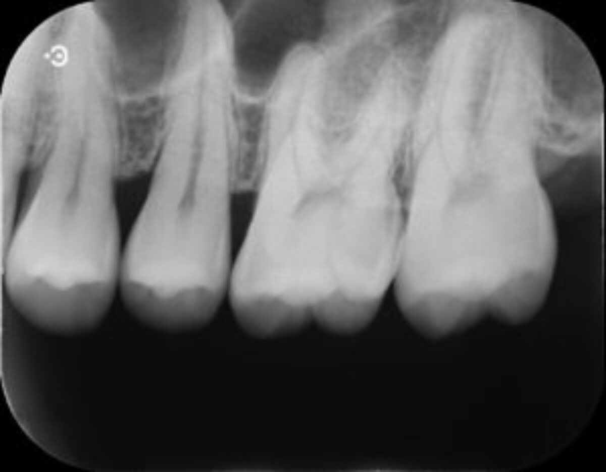 歯医者でのレントゲン撮影について｜神戸北野Nデンタルクリニック